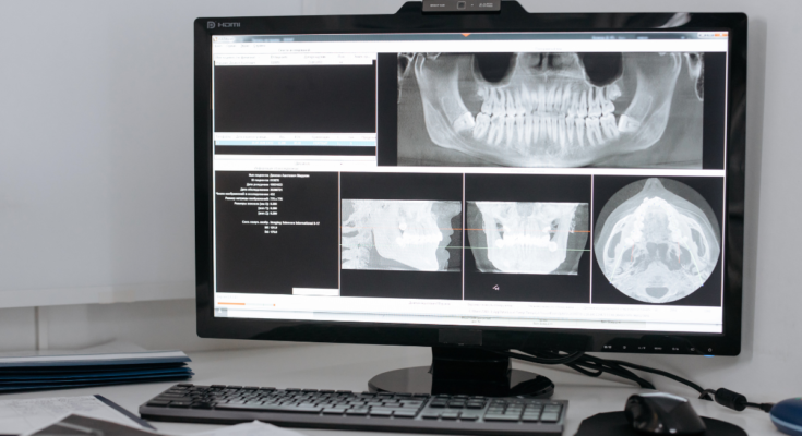 dental-x-ray